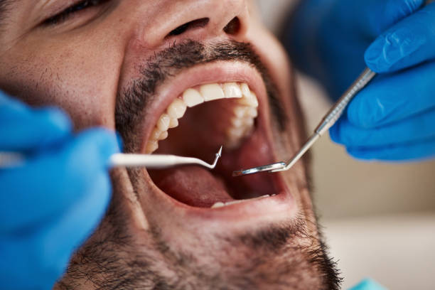 Best Emergency Dental Care  in Fort Dick, CA